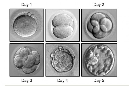 Stages of Embryo Development from Zygote (Day 1) to Blastocyst (Day 5)