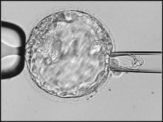 Preimplantation Genetic Testing (PGT) | Fertility & Reproductive ...